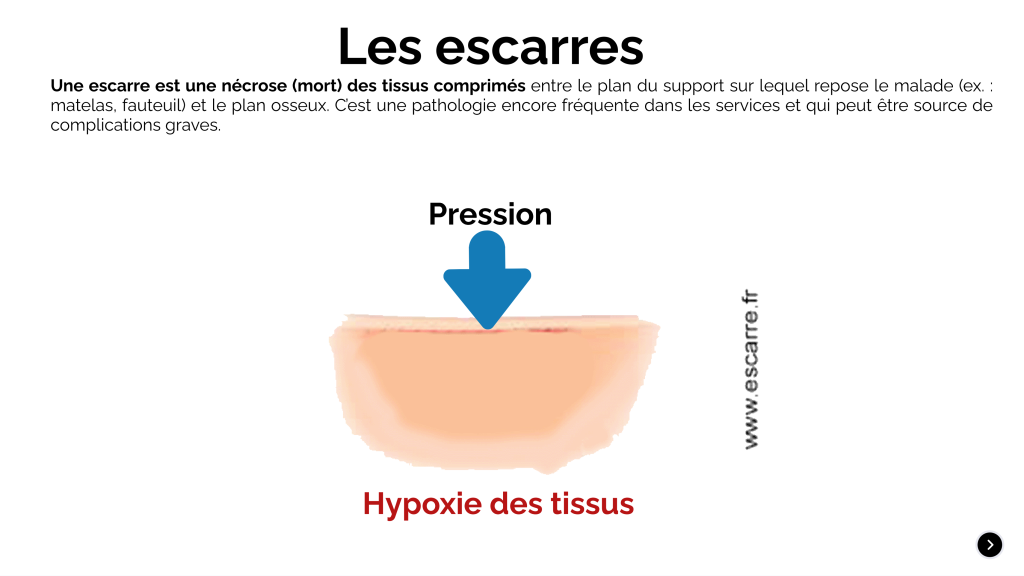 Physiopathologie-de-la-peau_7