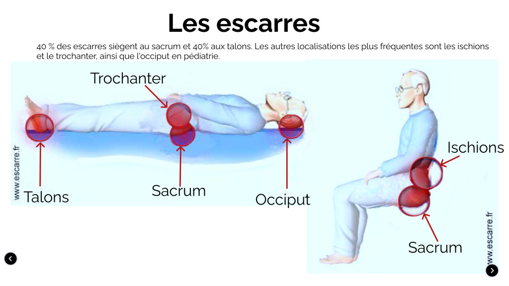 Physiopathologie-de-la-peau_8